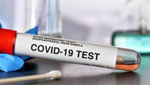 U KS potvrđeno 27 novih slučajeva zaraze koronavirusom