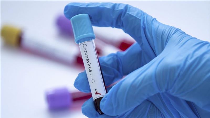 U KS potvrđeno 48 novih slučajeva zaraze koronavirusom
