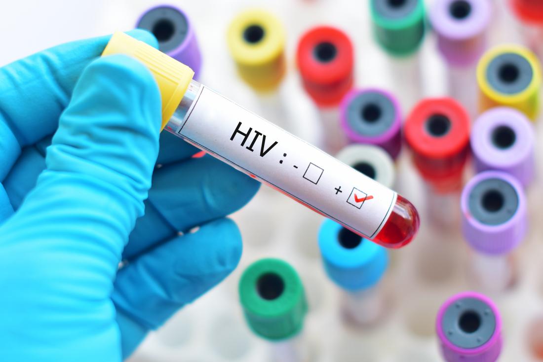 U Libiji veliki nedostatak lijekova za HIV/AIDS