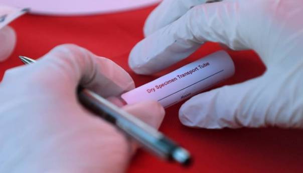 U ljekarne Srbije stigli kućni testovi na koronavirus