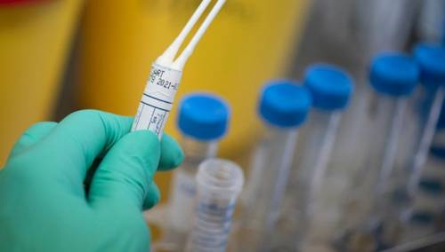 U Moskvi počinje besplatno testiranje na koronavirus