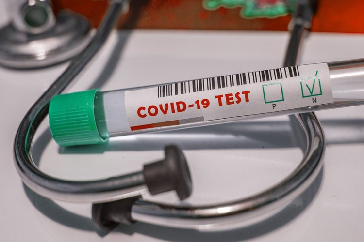 U Nišu proizveden prvi srpski test na Covid-19