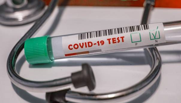 U Nišu proizveden prvi srpski test na Covid-19