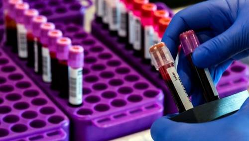 U Nizozemskoj 63 nova smrtna slučaja, 811 novozaraženih