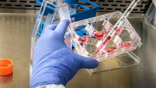 U Njemačkoj potvrđeno još 247 novih slučajeva zaraze