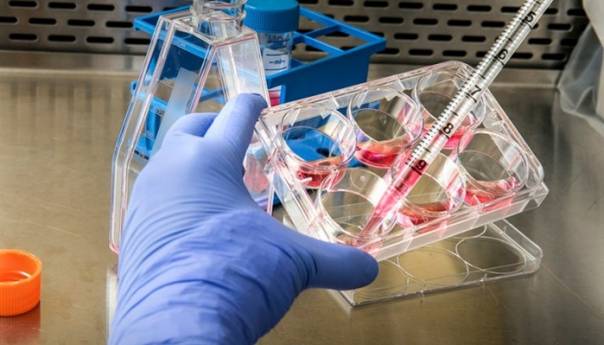 U RS 13 novozaraženih osoba, ukupno 1.408