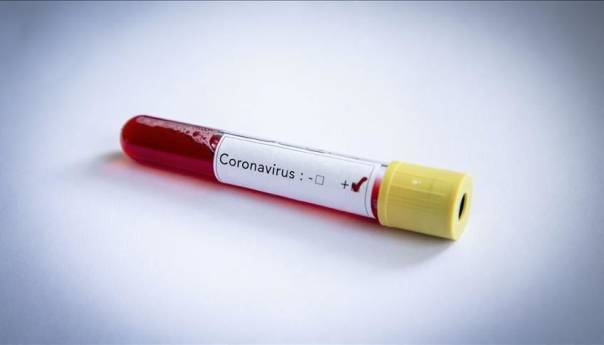 U RS 47 novih slučajeva virusa korona, pet preminulih