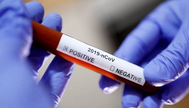 U RS još 53 nova slučaja zaraze, 112 u zadnja dva dana