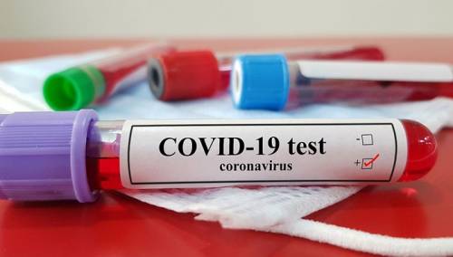 U RS 54 nova slučaja koronavirusa, tri osobe preminule