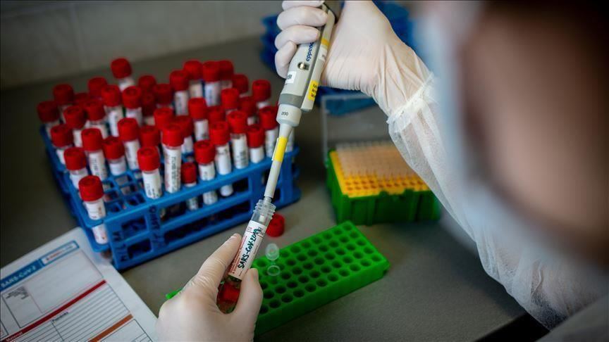 U RS 59 novozaraženih, jedna osoba preminula