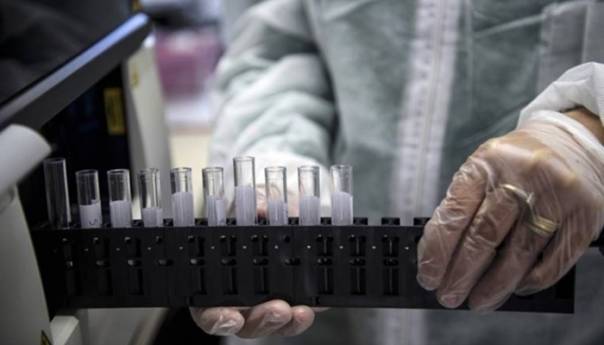U RS 71 novozaražena osoba, jedna osoba preminula