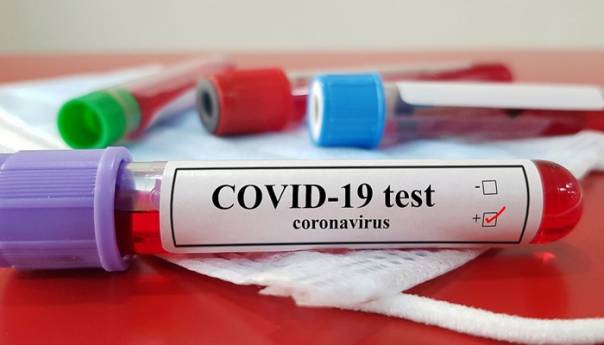 U RS 73 novozaraženih od koronavirusa, jedan smrtni slučaj