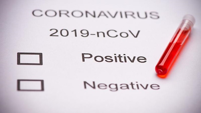 U RS 98 novih slučajeva koronavirusa