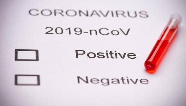 U RS 98 novih slučajeva koronavirusa