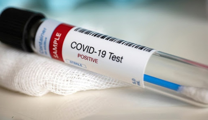 U RS jedna osoba pozitivna na koronavirus