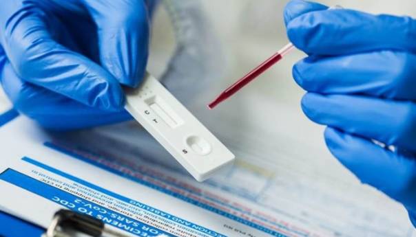 U RS još 11 osoba pozitivno na koronavirus