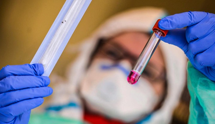 U RS još 125 osoba zaraženo koronavirusom