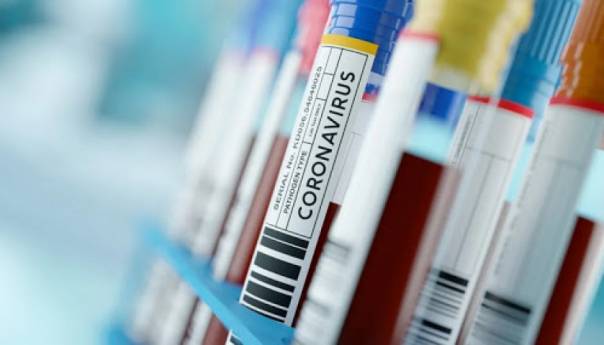 U RS koronavirusom zaraženo još 86 osoba