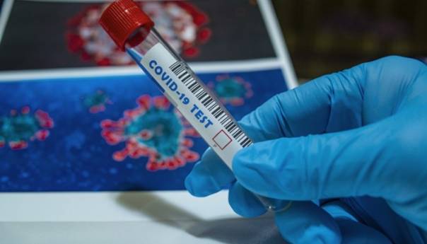 U RS novih 146 slučajeva zaraze koronavirusom
