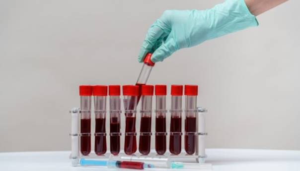 U RS testirano 386 uzoraka, koronavirus potvrđen kod još 53 osobe