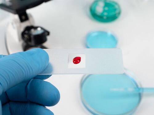 U RS-u 16 slučajeva oboljelih od HIV/AIDS-a, najviše homoseksualaca