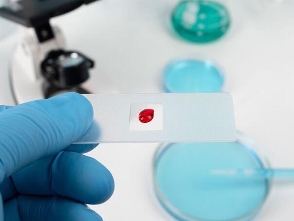 U RS-u 16 slučajeva oboljelih od HIV/AIDS-a, najviše homoseksualaca