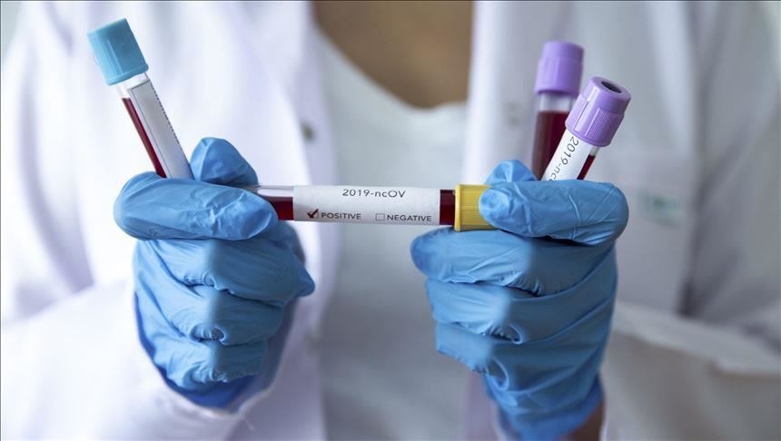 U RS-u 30 osoba pozitivno na koronavirus