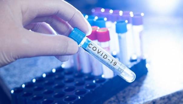 U RS-u novih 107 slučajeva korona virusa