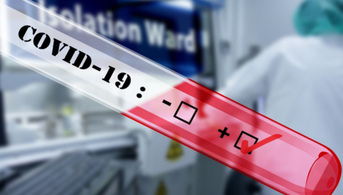 U SAD ukradeno više od 200 milijardi dolara pomoći tokom pandemije korona virusa