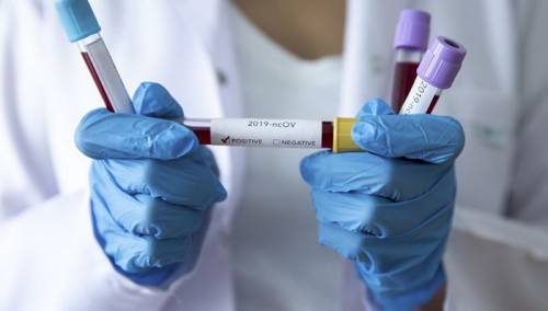 U Sarajevu 72 nova slučaja, jedan pacijent preminuo