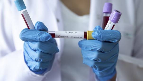 U Sarajevu 72 nova slučaja, jedan pacijent preminuo