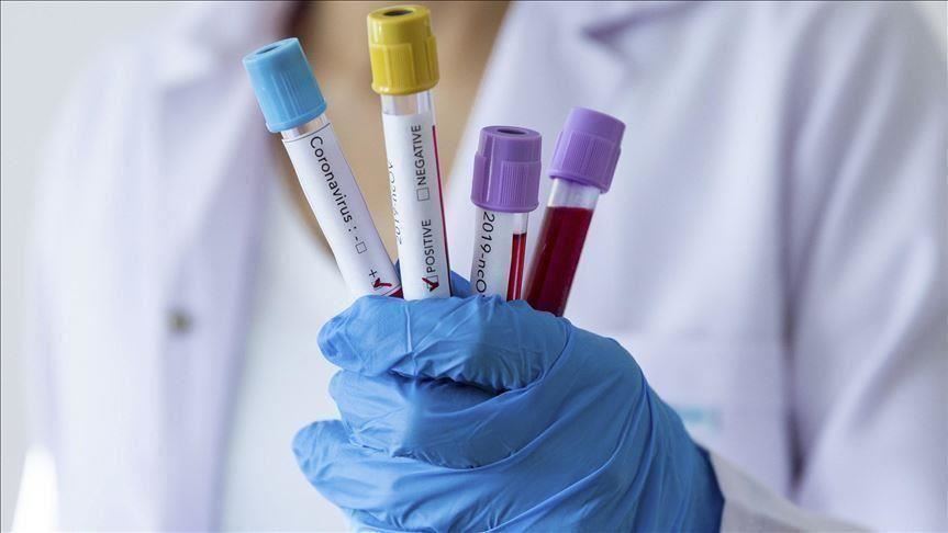 U Sjevernoj Makedoniji najviše mrtvih za 24 sata od početka epidemije