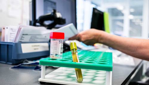 U Sloveniji 21 novozaraženi koronavirusom