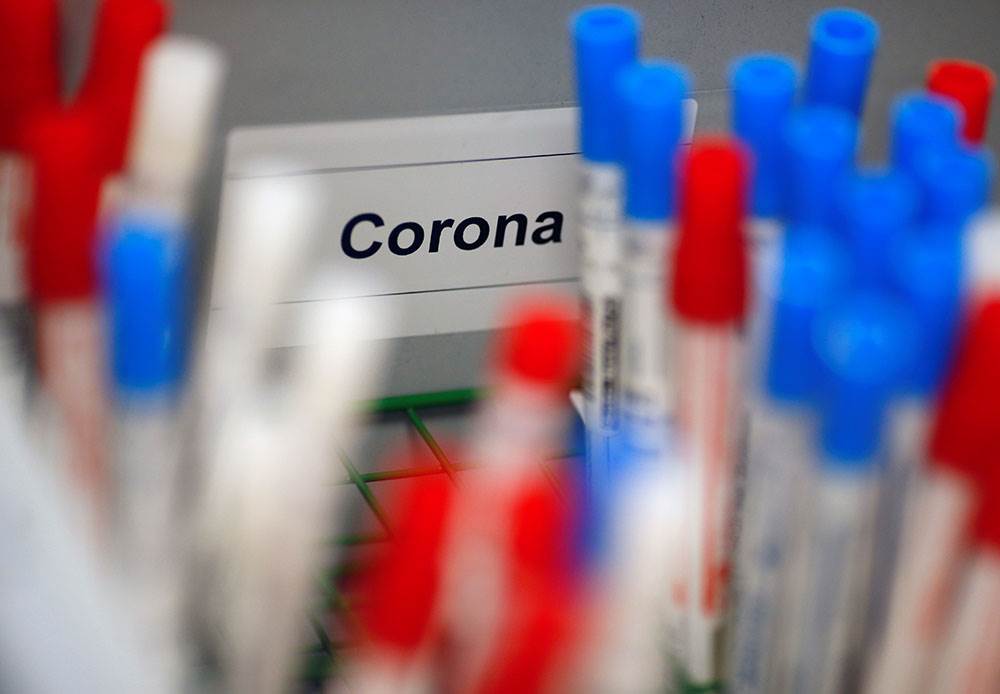 U Sloveniji 37 novih zaraza koronavirusom