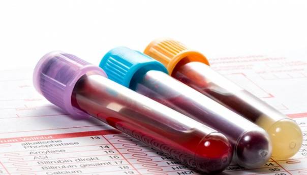 U Sloveniji 88 novih slučajeva, bolnice se pune