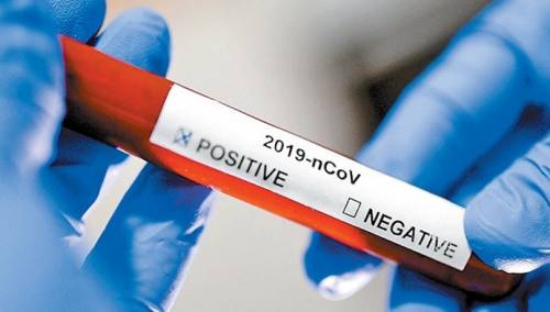 U Sloveniji jedan novi slučaj zaraze