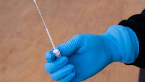 U Sloveniji registrovana 24 nova slučaja virusa korona