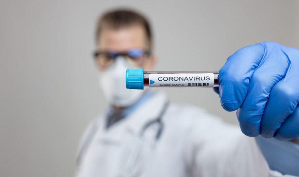 U Sloveniji se nastavlja poboljšanje epidemiološke situacije