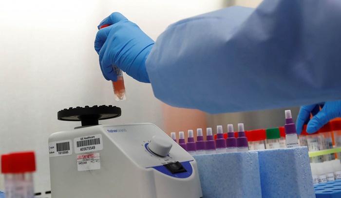 U Srbiji 148 novooboljelih od koronavirusa