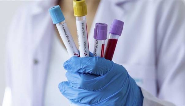 U Srbiji 27 novozaraženih koronavirusom