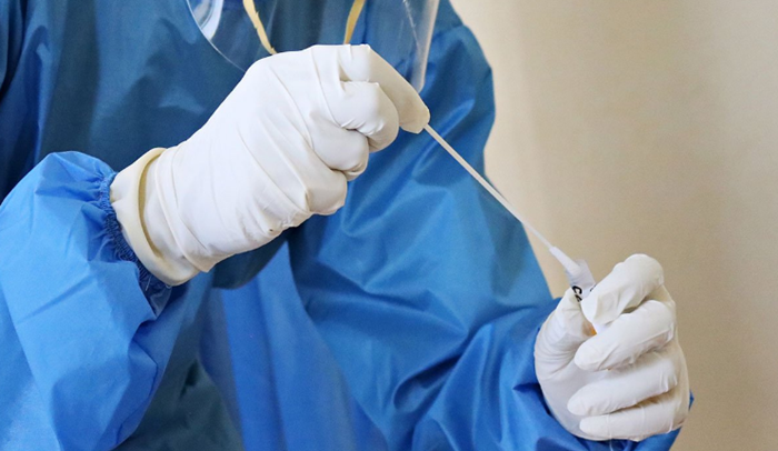 U Srbiji 428 novozaraženih, preminulo pet osoba