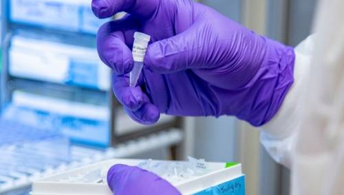 U Srbiji 82 novozaraženih, dvije osobe preminule od koronavirusa