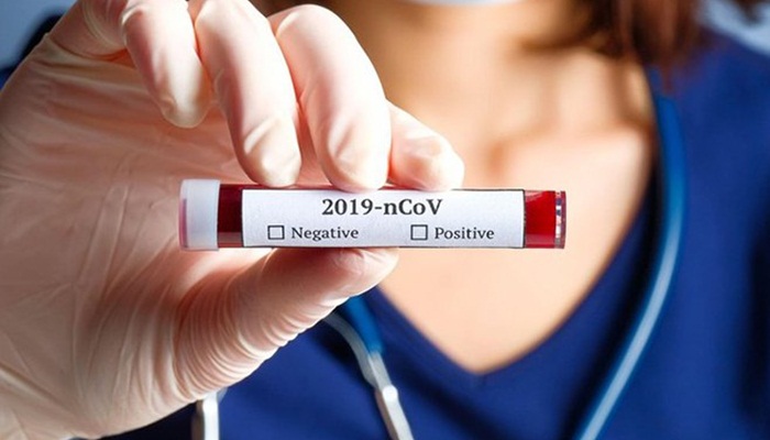 U Srbiji još 11 novih slučajeva koronavirusa