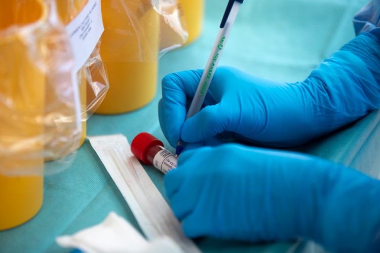 U Srbiji još 71 slučaj korona virusa, preminula jedna osoba