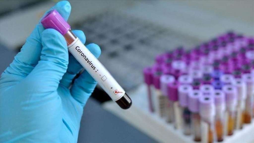 U Srbiji koronavirusom zaražena 861 osoba