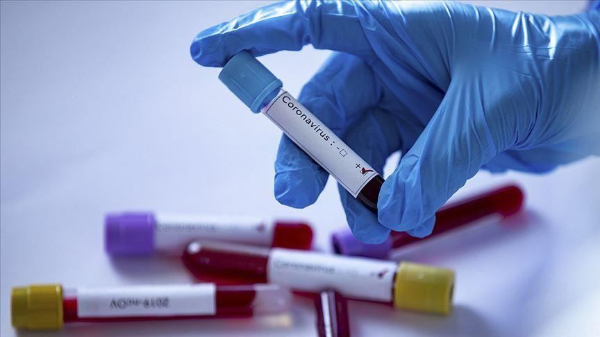 U Srbiji na koronavirus pozitivno još 339 osoba, osam preminulo