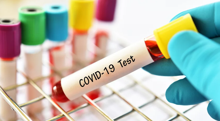 U Srbiji novih šest slučajeva virusa korona