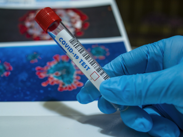 U Srbiji obavezno nošenje maski u zdravstvenim ustanovama