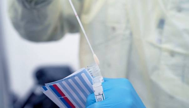 U Srbiji od koronavirusa preminula jedna osoba, 34 zaražene