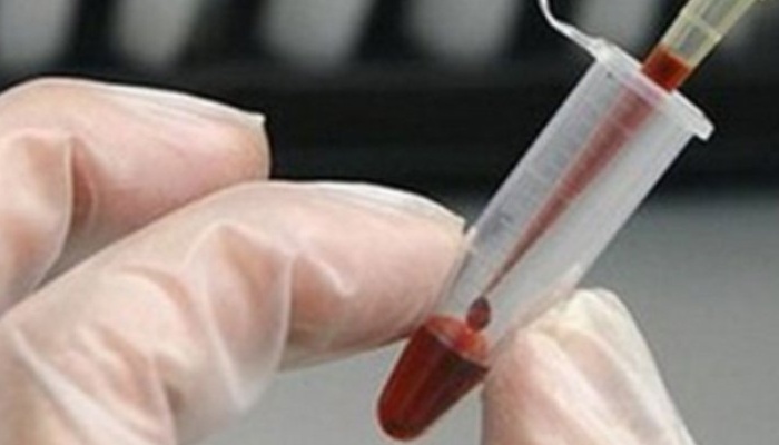 U Srbiji potvrđen 81 slučaj zaraze groznicom Zapadnog Nila